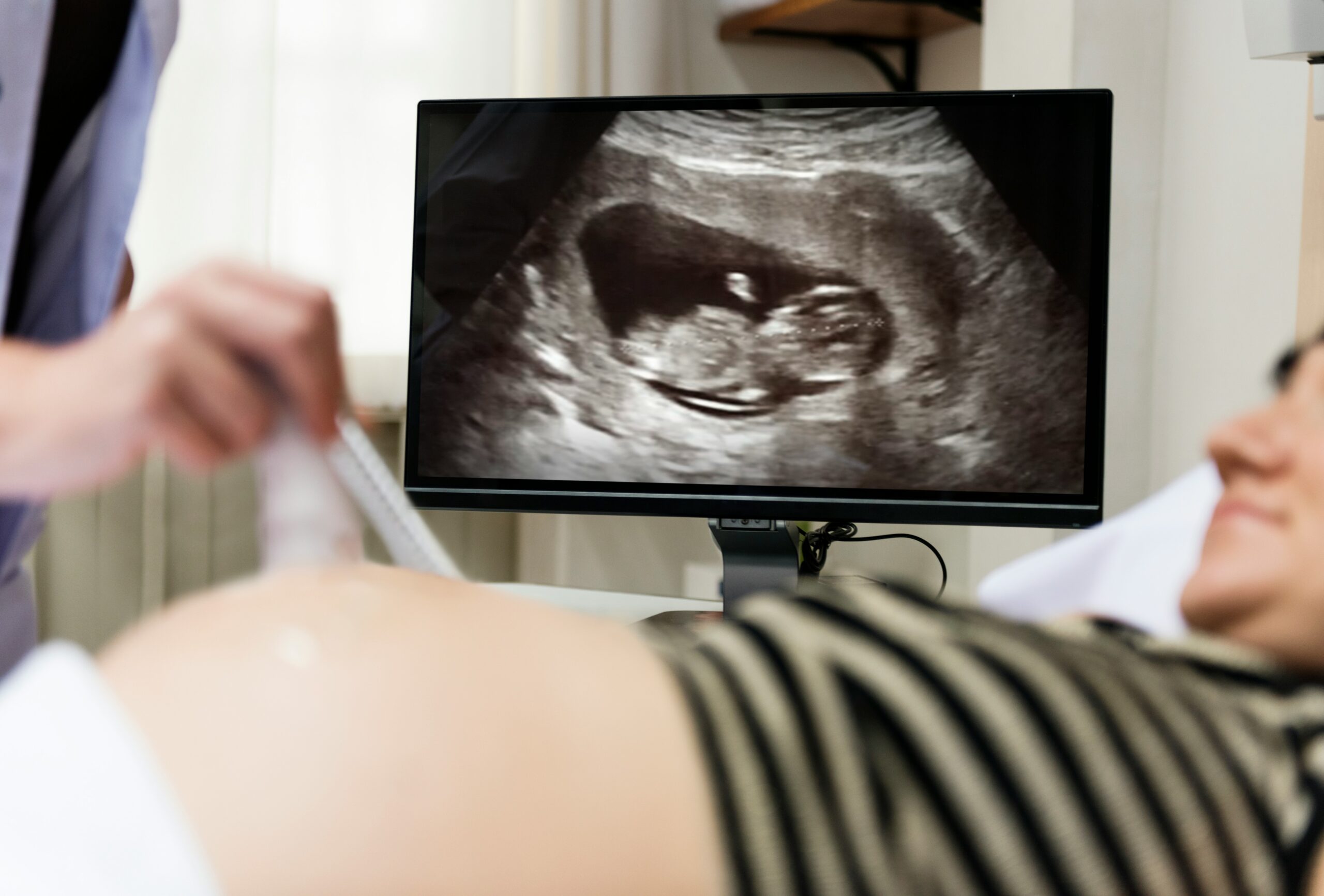Ultrasound exam at Pathways Clinic